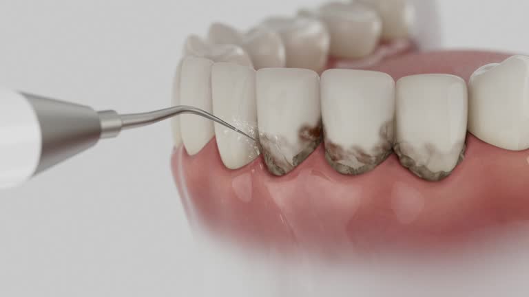 Trusted Root Canal Treatment service in Richmond West, FL - Dentist Open Now